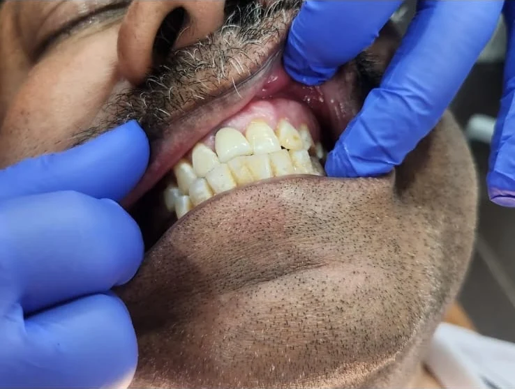 Restorative treatment — clinical view