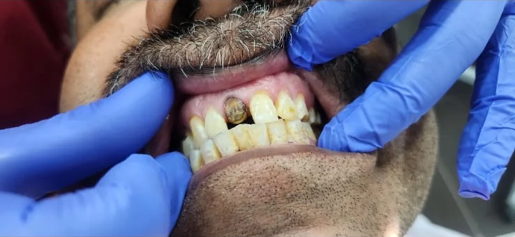 Restorative treatment — close-up